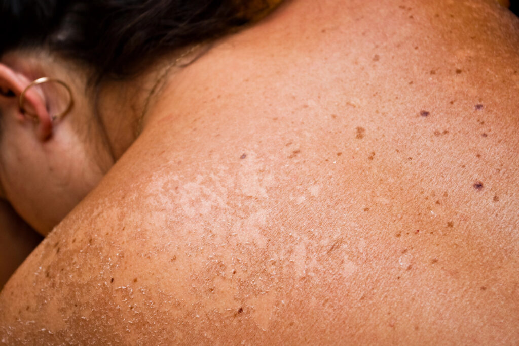 Protect Yourself From The Dangers Of Uv Exposure Protect Yourself From the Dangers of UV Exposure
